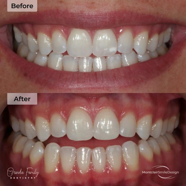 Images Orinda Family Dentistry