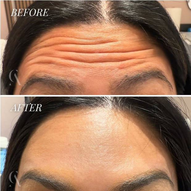 Images Corinne Aesthetics | Laser & Skin