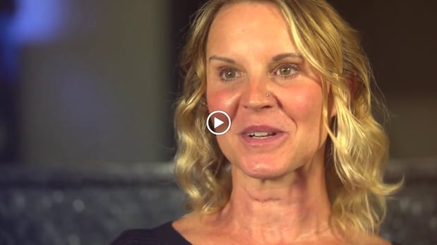 Images Jungmeyer & Suresh Dental Enterprises LLC