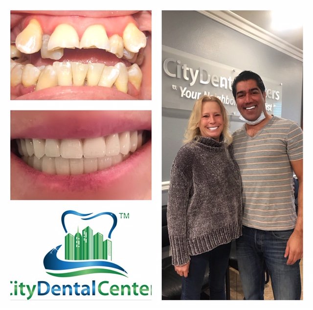 City Dental Centers Corona Photo