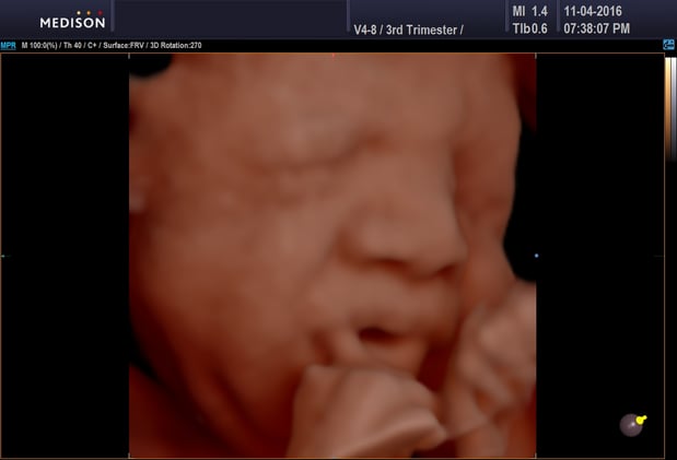 Images Heavenly 3D 4D Ultrasounds