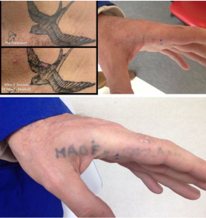 Images Medical Sthetic