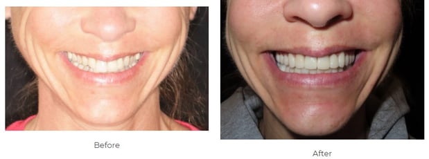 Images Aspen Ridge Dental