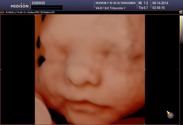 Images Heavenly 3D 4D Ultrasounds-Upland