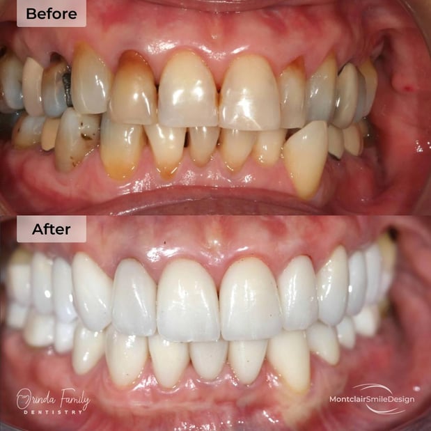 Images Orinda Family Dentistry