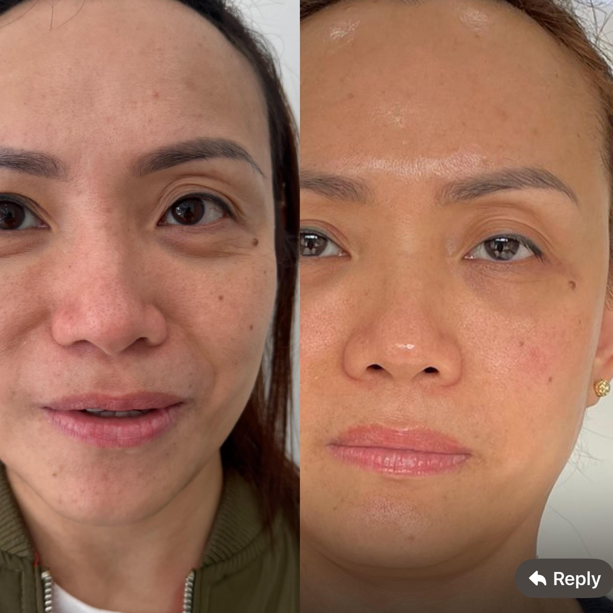 Images Luminous Skin