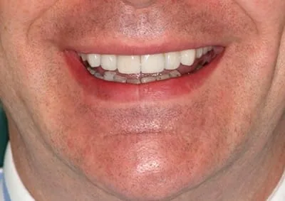 Images Smile Dental Laboratory