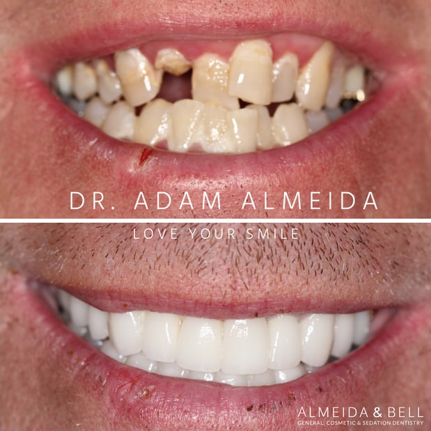 Images Almeida & Bell Dental Lone Tree - General, Cosmetic, and Implant Dentistry