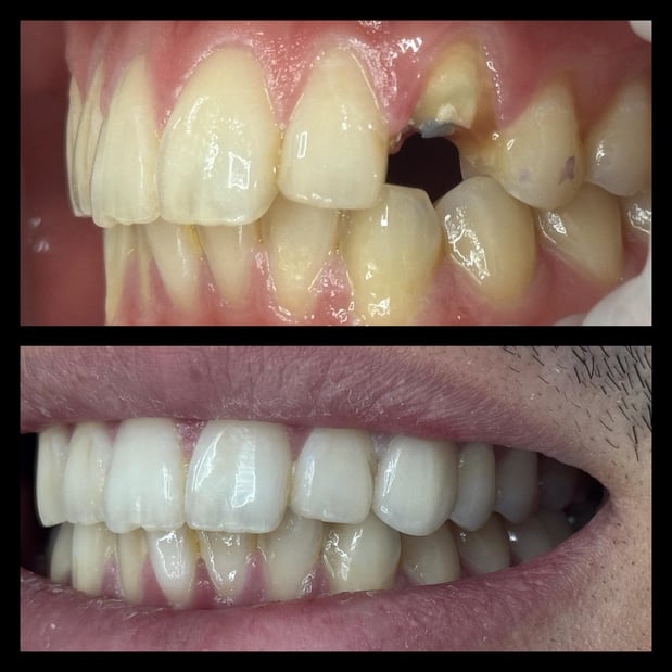 Images smile4me Dental Care - Astoria, Queens