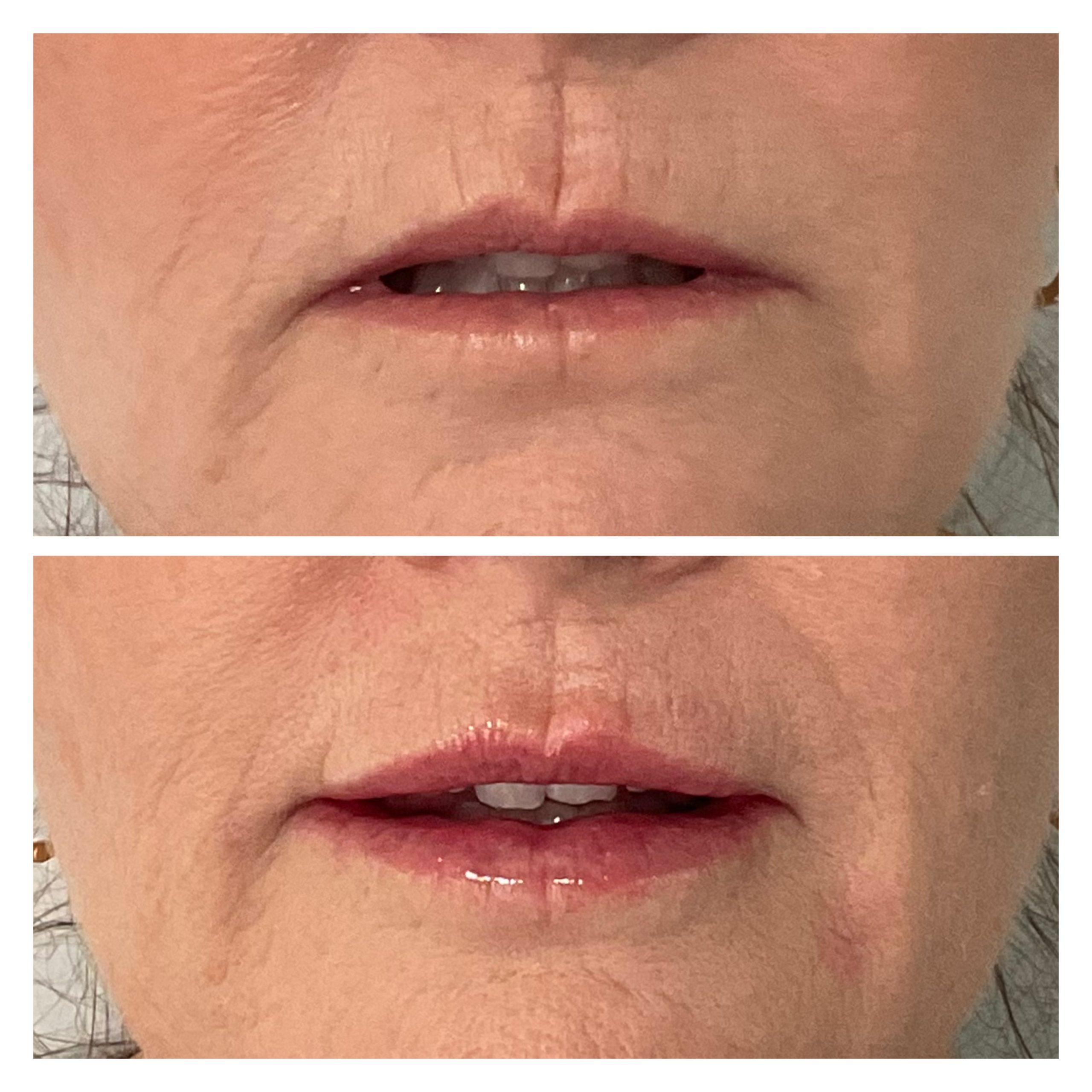 Images Exthetics Aesthetics Clinic