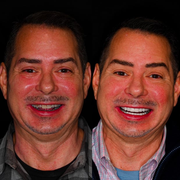 Images Nashville Wisdom Teeth and Implant Solutions