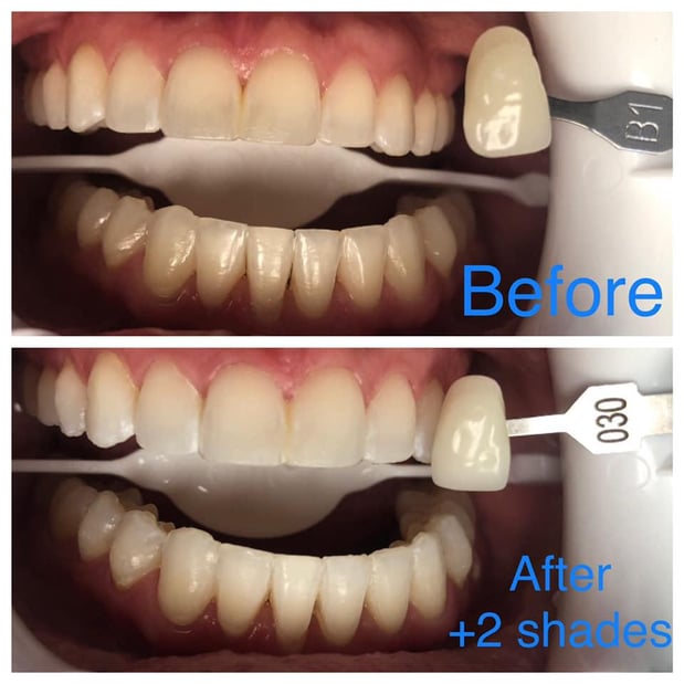 Images Salt Lake Dental Care - Clint Blackwood DDS