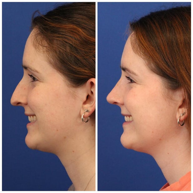 Images Dr. Sumit Bapna, MD