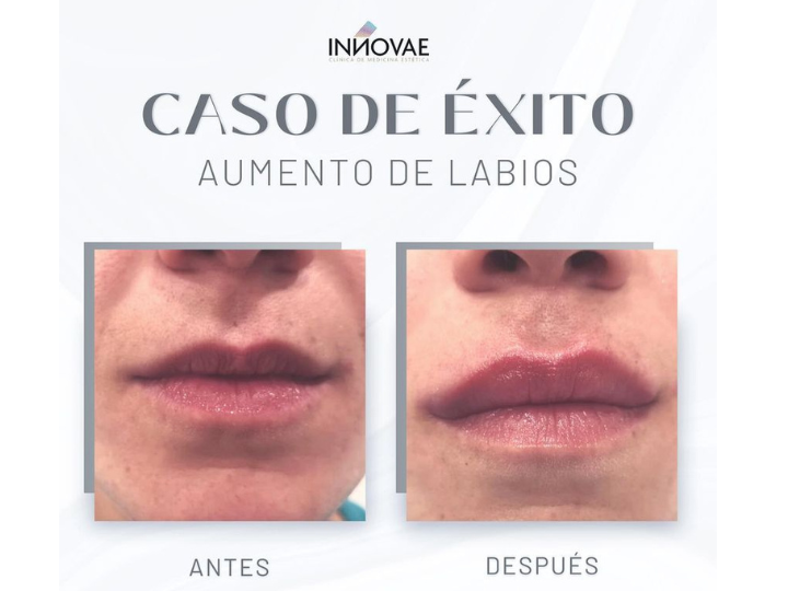 Images Clínica Innovae Medicina Estética