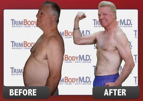 Images TrimBody M.D.