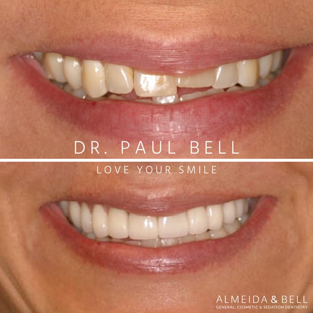 Images Almeida & Bell Dental Lone Tree - General, Cosmetic, and Implant Dentistry