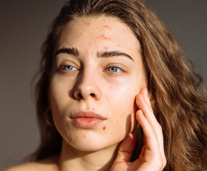 Images Pure Esthetics Birmingham