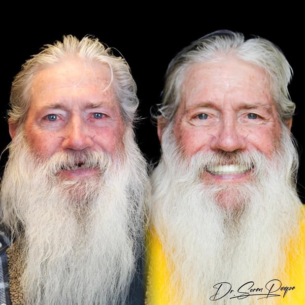 Images Smile Now Denver Dentures and Implants