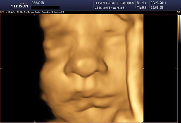 Images Heavenly 3D 4D Ultrasounds-Upland