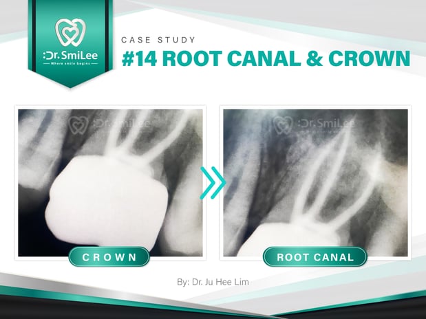 Images Dr Smilee Dental of Waco Family, Medicaid, Dental Implant, Emergency Dentistry