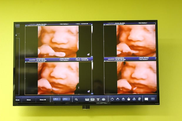 Images Heavenly 3D 4D Ultrasounds-Upland