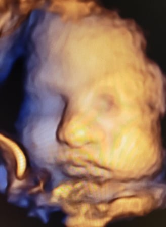 Images Love At First Sight 3D/4D Ultrasound Imaging Studio, LLC