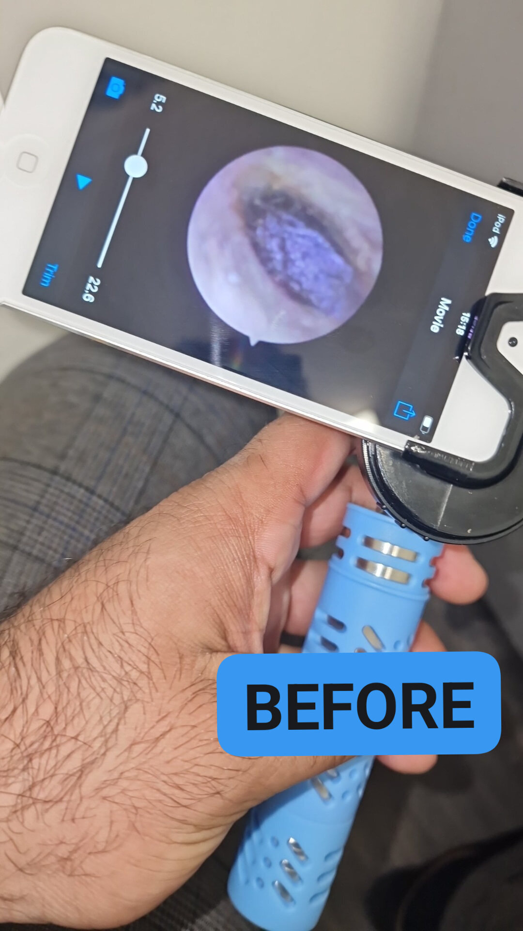 Images MW Ear Wax Removal