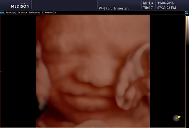 Images Heavenly 3D 4D Ultrasounds