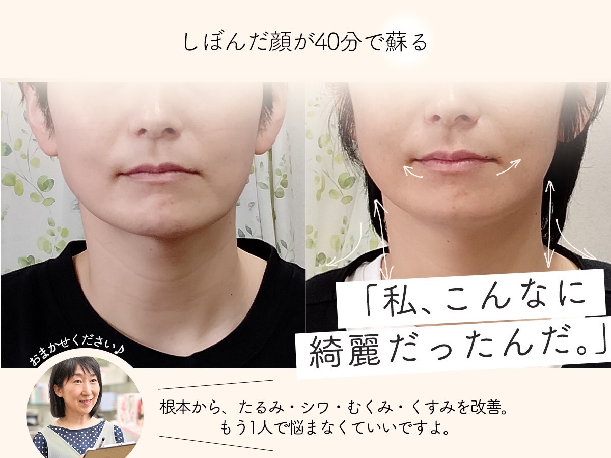 Images 目元・口元のたるみ&眉間シワ改善専門サロン