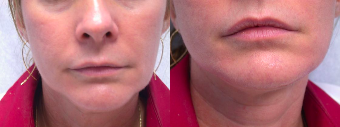Before & After from Millennium Medical | Chevy Chase, MD