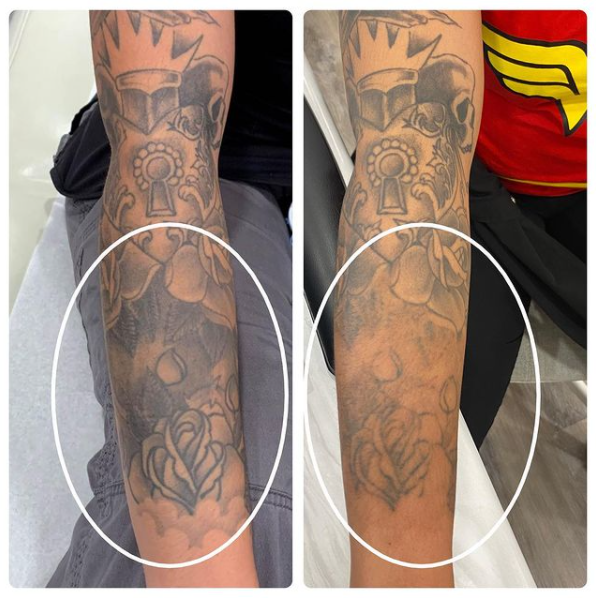 Images MedDerm Dermatology