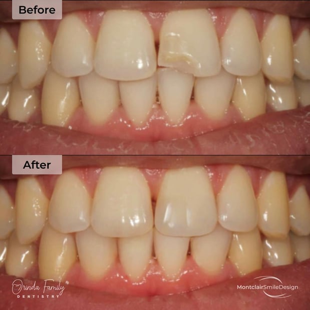 Images Orinda Family Dentistry