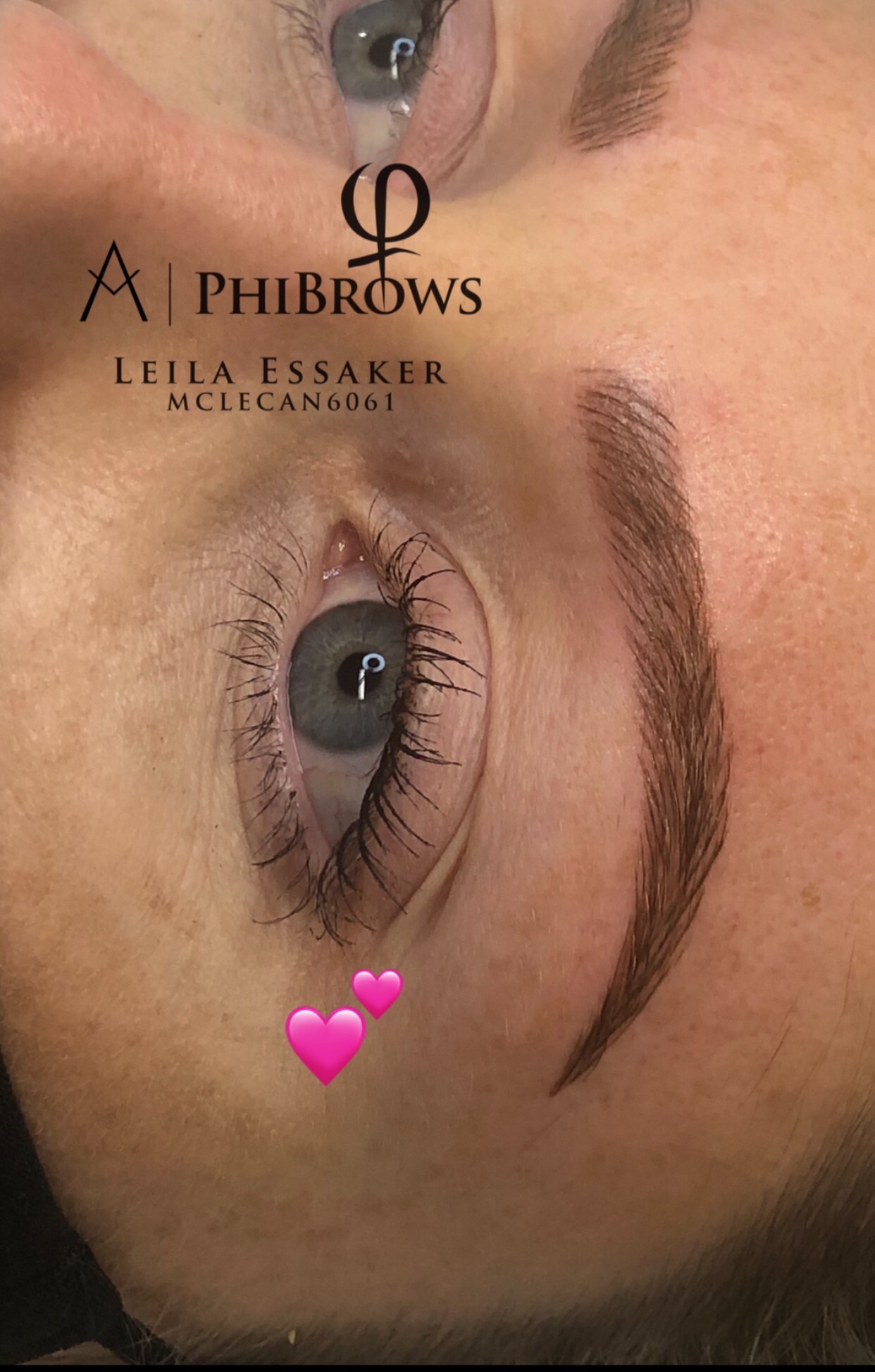 Images Clinique d'Esthétique Leila - Hydrafacial, Microblading, Épilation Laser Sainte-Foy