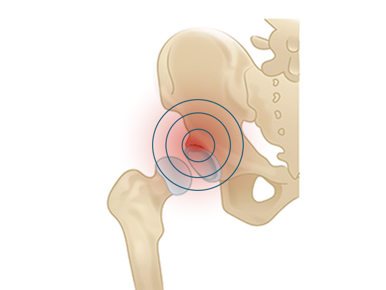 Cncrns_Cndtns-hippain-front-392x294@2x.jpg