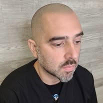 Images The Scalp Master