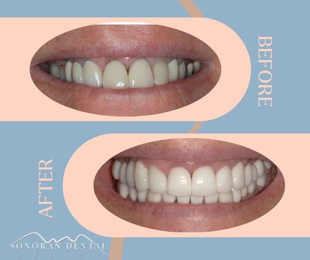 Images Sonoran Dental Design