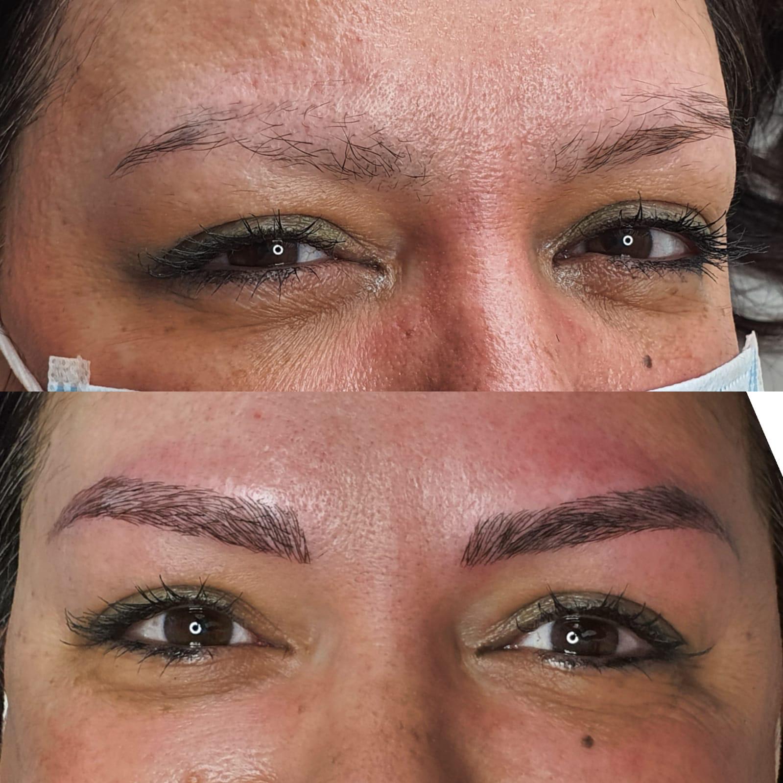 Images Centro De Estética Avanzada Y Láser Verónica Vico