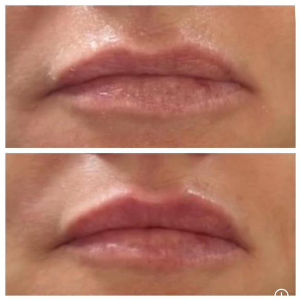 Images Body Lounge Park Cities - Whole Body Wellness & Medical Aesthetics, Dallas, TX