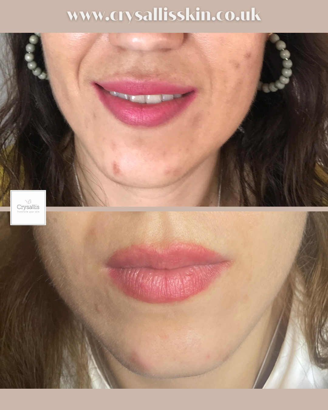 Images Crysallis Skin Clinic