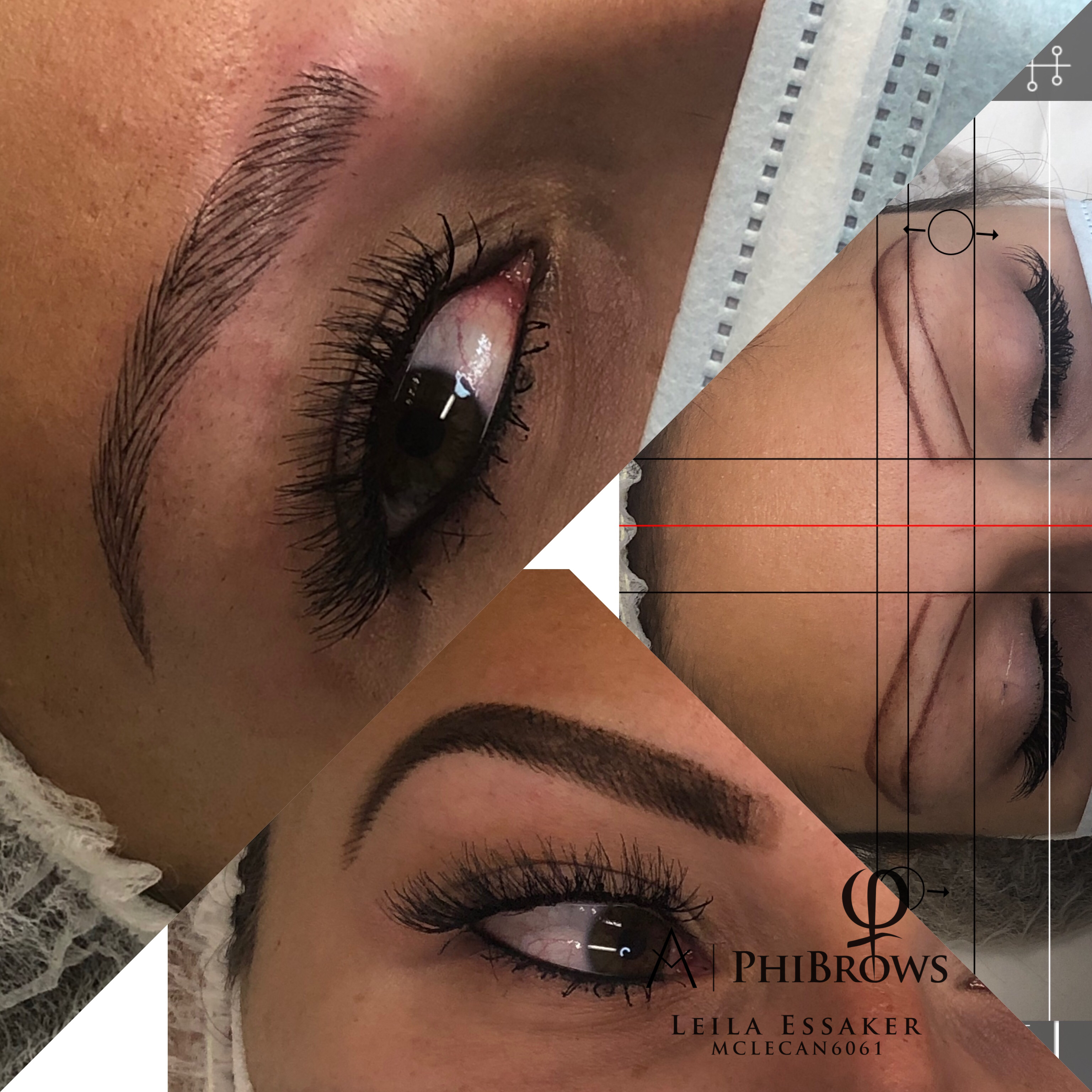 Images Clinique d'Esthétique Leila - Hydrafacial, Microblading, Épilation Laser Sainte-Foy