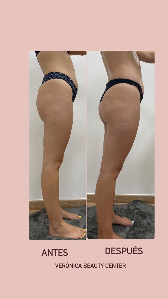 Images Verónica Beauty Center