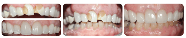 Images Aspire Dental Care PLLC