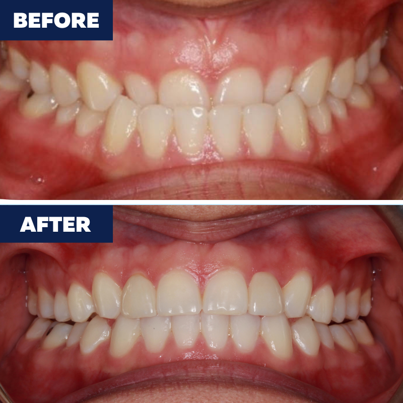 Images Orthodontics of El Segundo