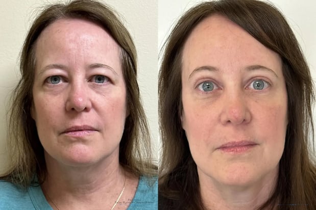 Images Providence Facial Plastic and Cosmetic Surgery