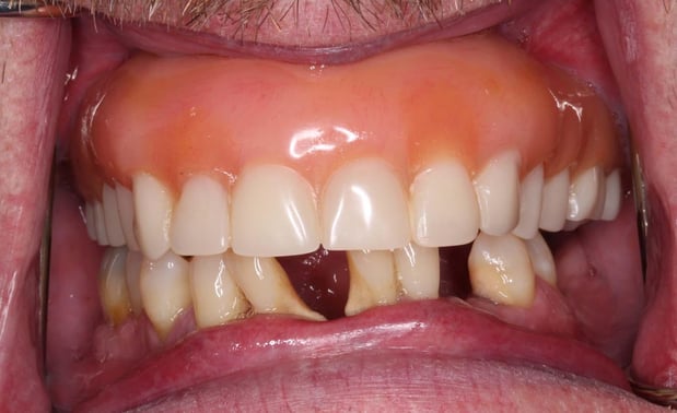 Images Paladin Dental