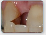 Foto's Tandtechnisch Laboratorium Dental Dokkum