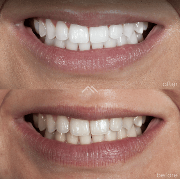 Images Foothill Modern Dental - Selina Sarno, DDS