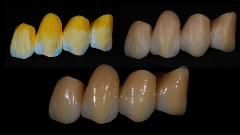 Images Enamel - Ianniello Lorenzo Maria