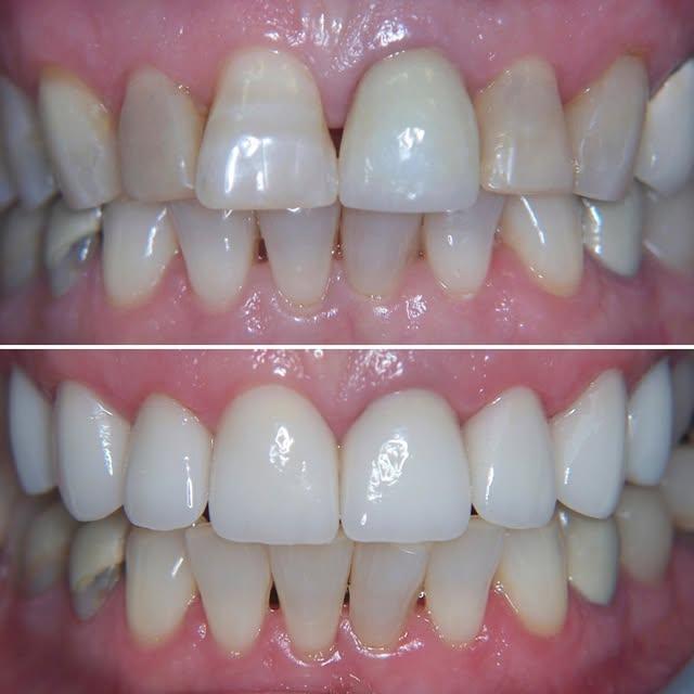 Images Smiles By Eddie: Dr. Edmond Ahdoot DDS
