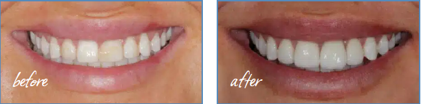 Images Merrell & Nichols Dentistry